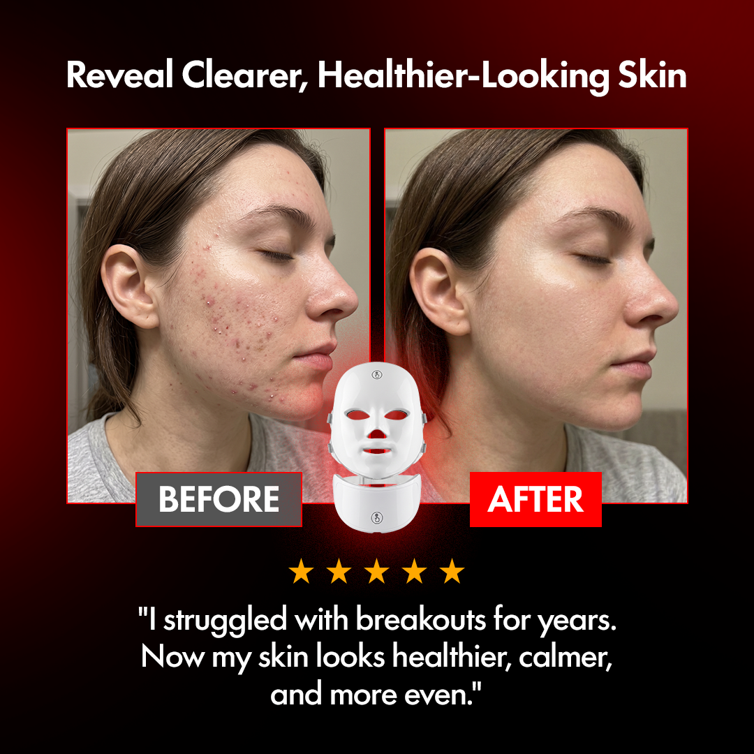 Suevé™ Pro LED Face & Neck Mask